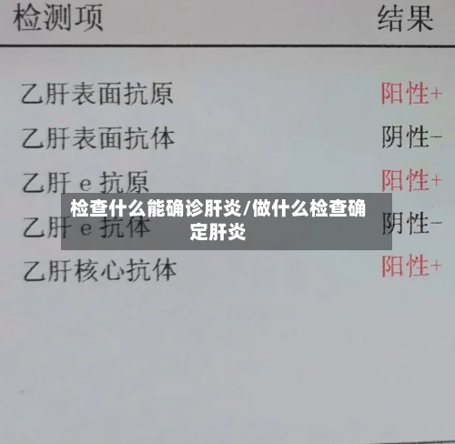检查什么能确诊肝炎/做什么检查确定肝炎
