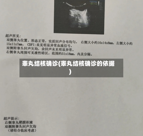 睾丸结核确诊(睾丸结核确诊的依据)-第2张图片