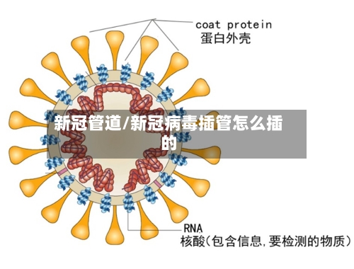 新冠管道/新冠病毒插管怎么插的-第1张图片