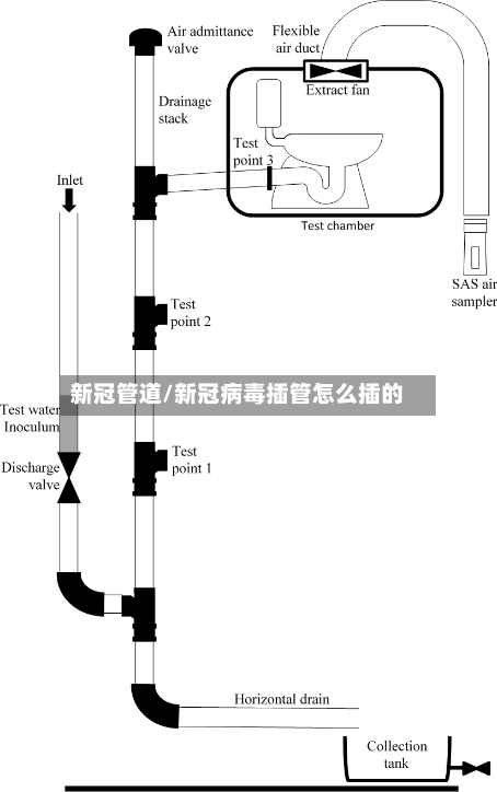 新冠管道/新冠病毒插管怎么插的-第3张图片