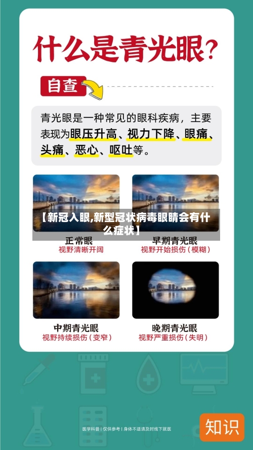 【新冠入眼,新型冠状病毒眼睛会有什么症状】-第2张图片