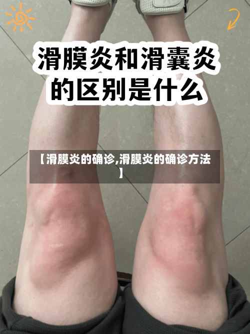 【滑膜炎的确诊,滑膜炎的确诊方法】-第3张图片